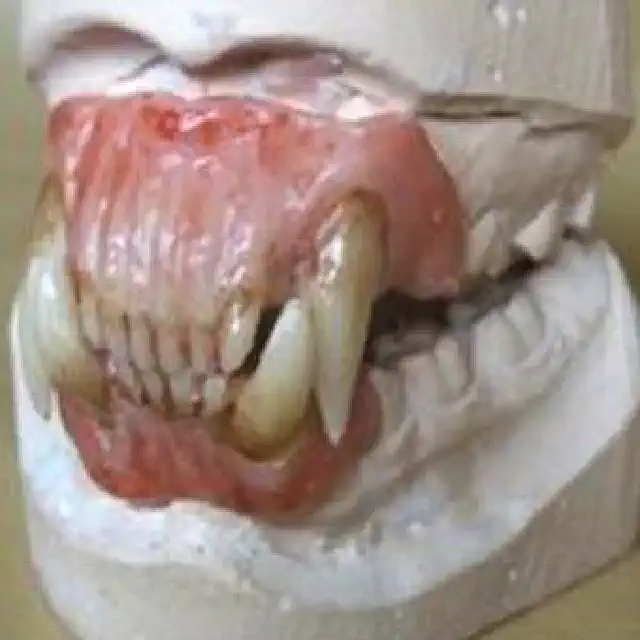 Dental